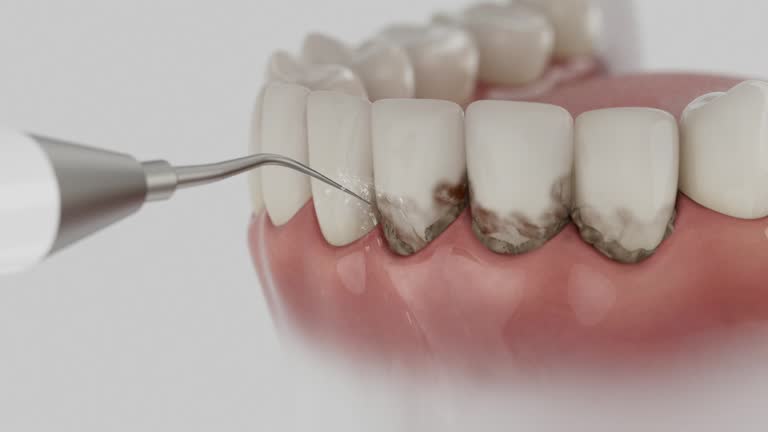 Reliable Dental contractor in Allentown, NJ by Smile Center Dentistry